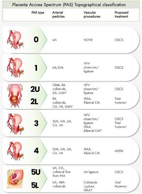 Frontiers Advantages Of Individualizing The Placenta Accreta Spectrum